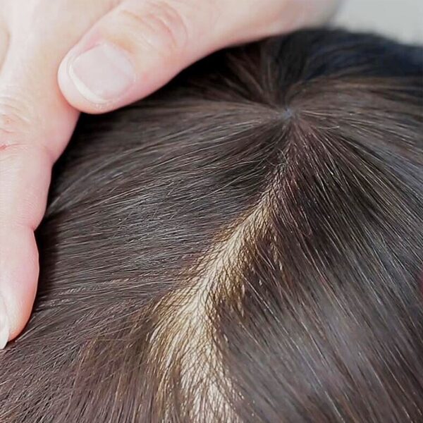 INS-0.08mm-Injected-Thin-Skin-Hair-System-4