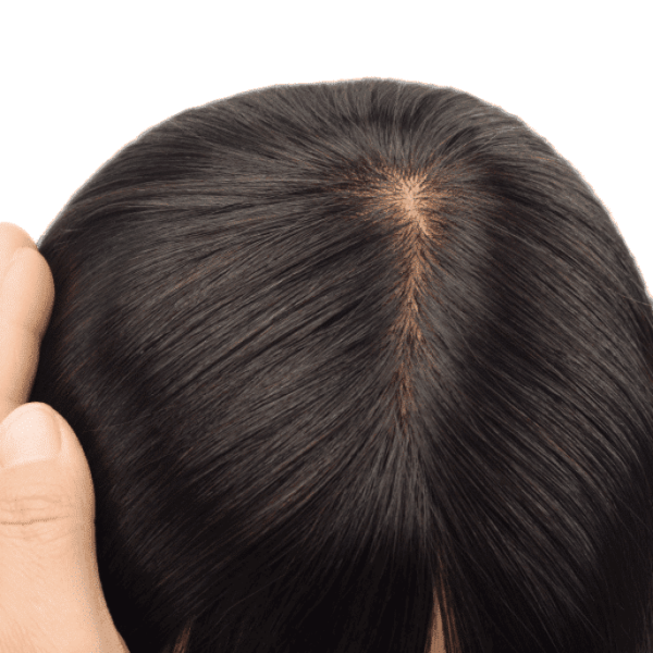 st-1-silk-top-hair-topper-4-1